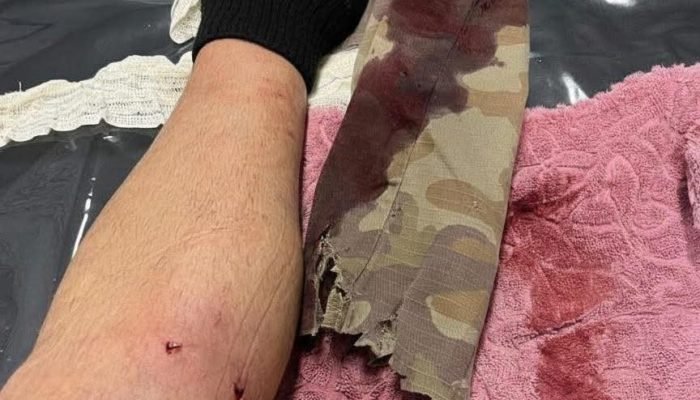 615811093_1445964340478623_3189354151886286677_n